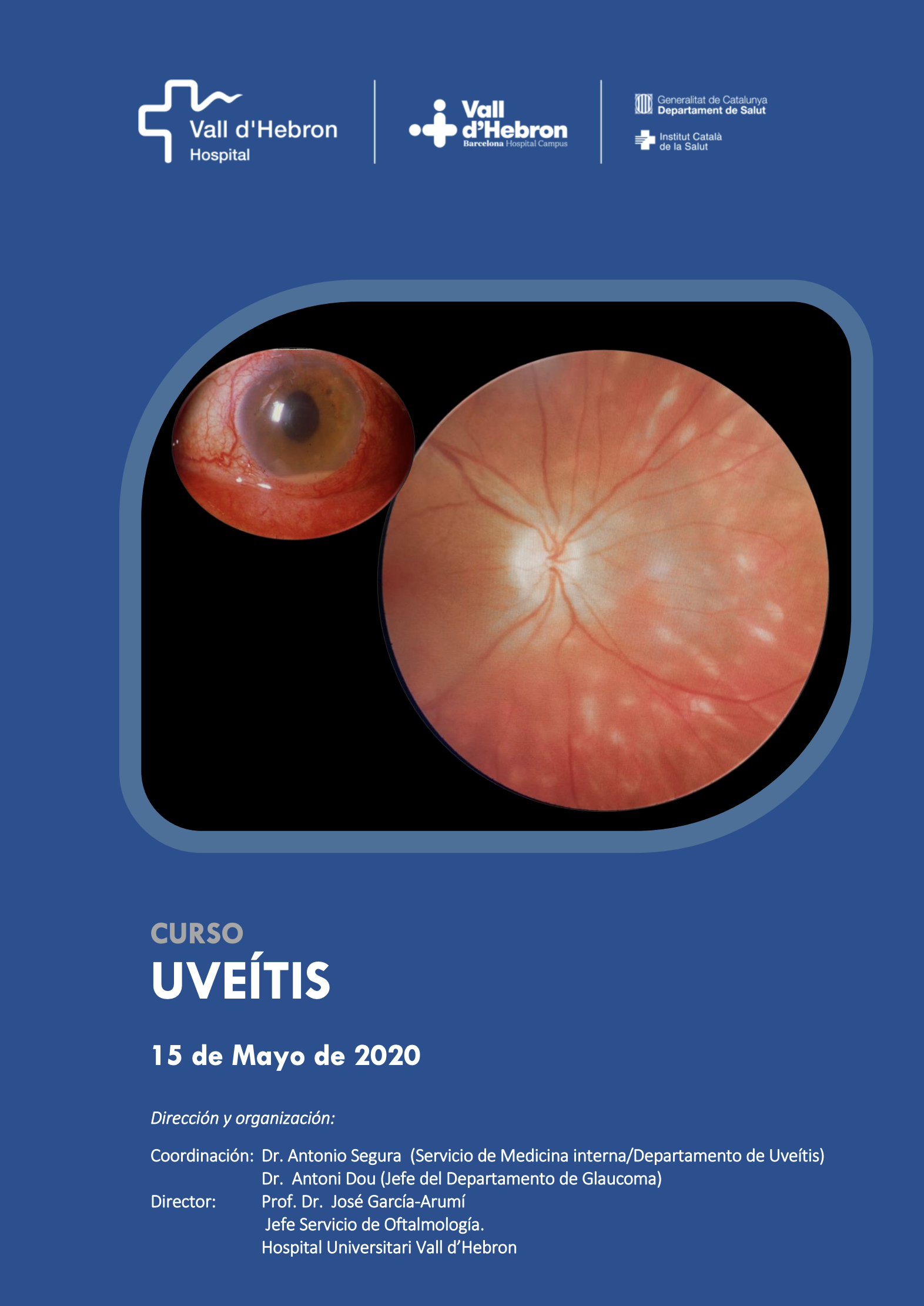 L’Hospital Universitari Vall d’Hebron organitza un curs sobre uveïtis